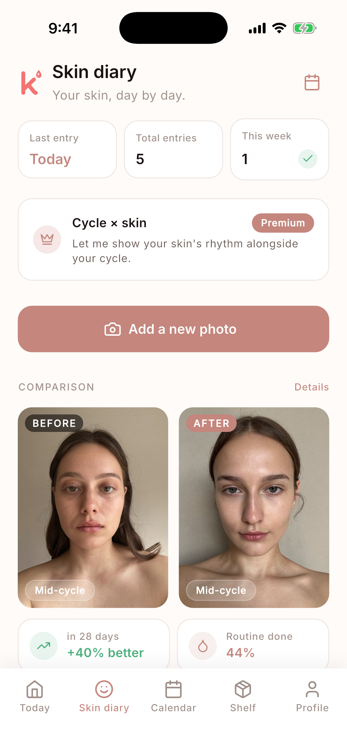 Kuzi — Skin diary screen